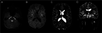 FIG 2