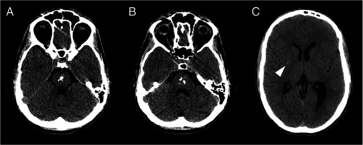 FIG 1