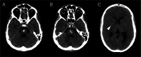 FIG 1