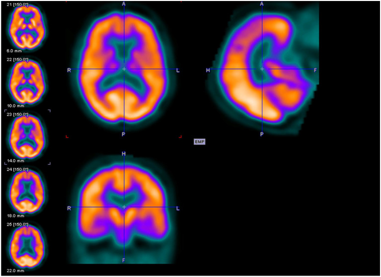 Figure 2.