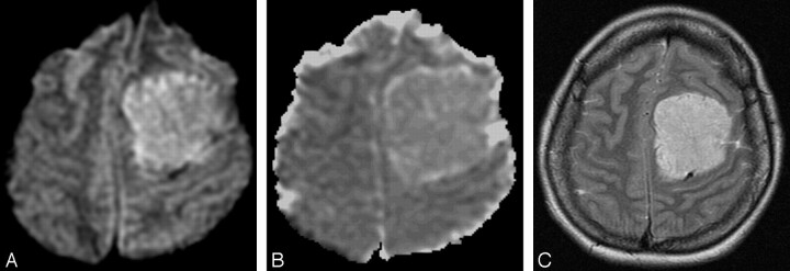 Fig 2.