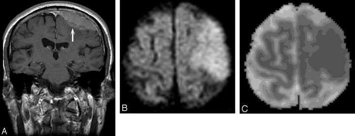 Fig 1.