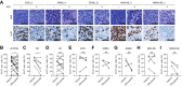 Figure 4. Elimusertib reduces the proliferation rate in PDX models of pediatric solid tumors. A, Exemplary hematoxylin and eosin and Ki-67 stainings of Ewing sarcoma, ARMS, ERMS, MNA NB, and NMNA NB PDXs treated with elimusertib or vehicle control. B–I, changes in the fraction of Ki-67–expressing cells for all PDXs combined (B), PDXs responding to elimusertib as defined per RECIST (OR, C) and PDXs with progressive disease (PD, D), Ewing sarcoma (E), ARMS (F), ERMS (G), MNA NB (H), and NMNA NB (I). (n = 10; paired, two-sided Student t test; error bars represent standard deviation, P = 0.0371, 0.0216, 0.4764, 0.9394, 0.4935, 0.2945, 0.7005, and 0.0933 for all PDXs combined, responding PDXs, PDXs with progressive disease, Ewing sarcoma, ARMS, ERMS, MNA NB, and NMNA NB, respectively); scale bar, 40 μm.