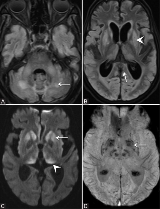 Figure 2 (A-D)