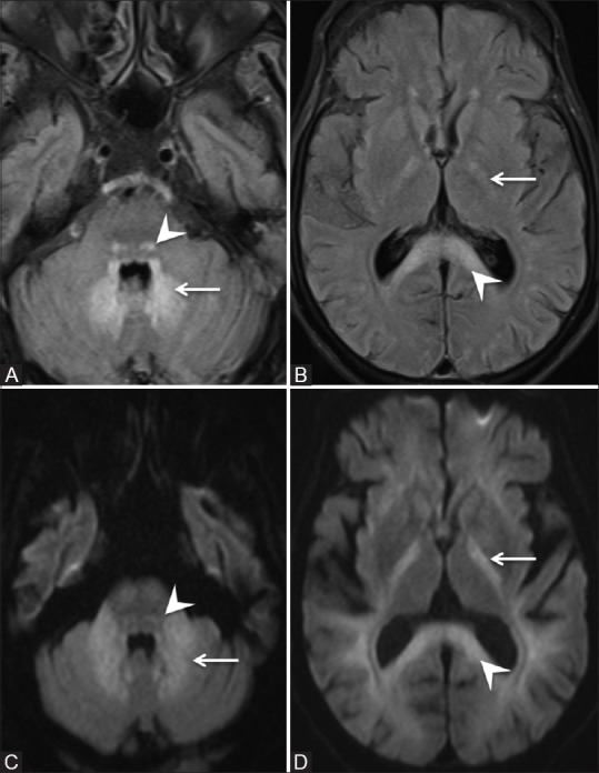 Figure 1 (A-D)