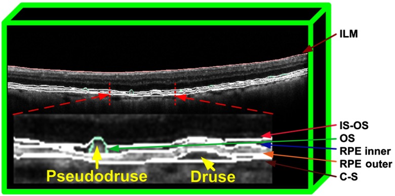 Fig. 1