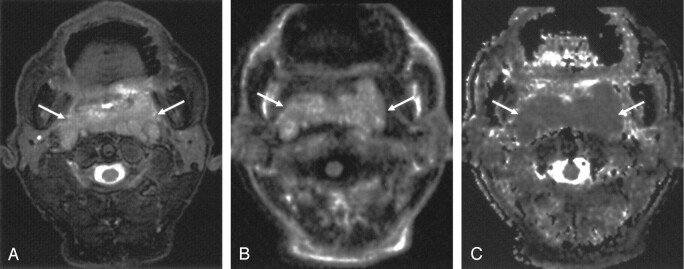 Fig 2.