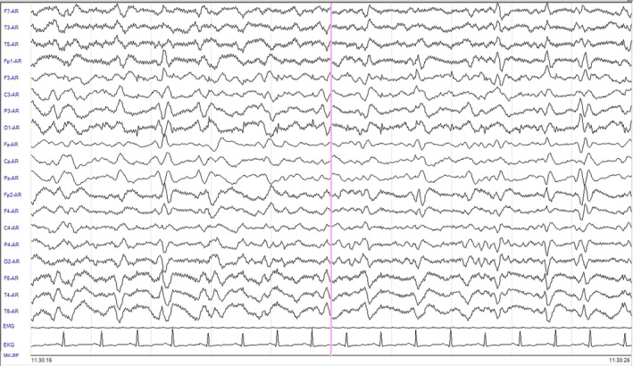 FIGURE 2