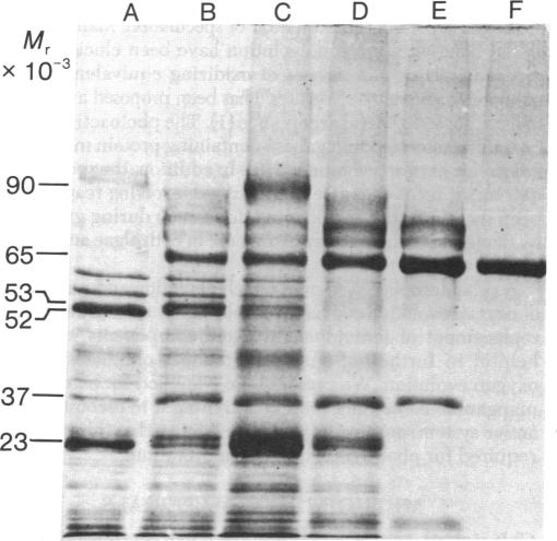 graphic file with name pnas00665-0273-a.jpg