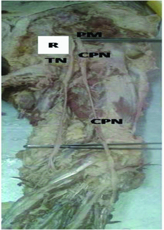 [Table/Fig-4]: