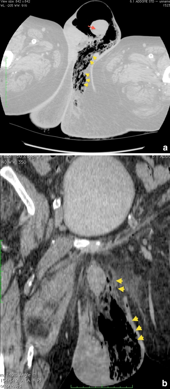 Fig. 2