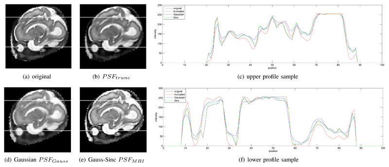 Fig. 9