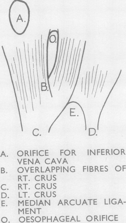 graphic file with name thorax00035-0016-d.jpg