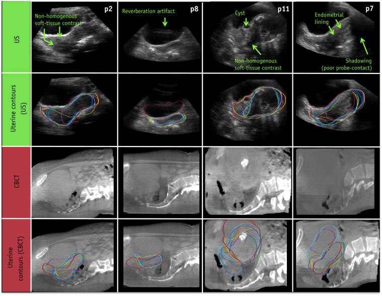 Fig. 1