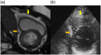Fig. 9