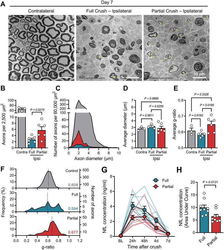 Long-term tactile hypersensitivity after nerve crush injury in mice is ...