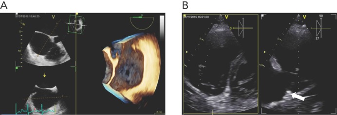 Figure 3: