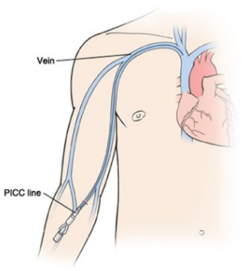 Fig. 1