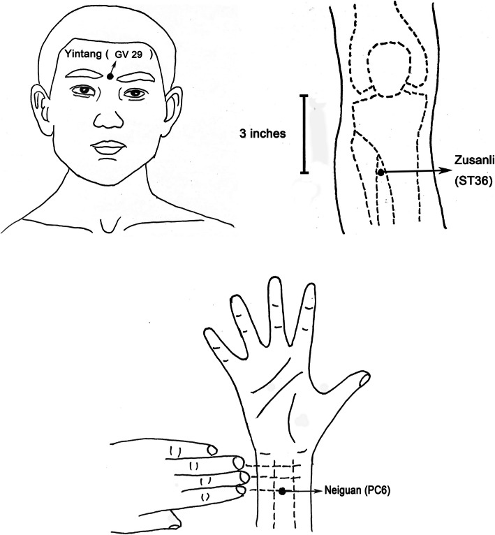 Fig. 2