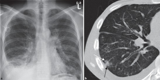 Fig. 19.91a,b