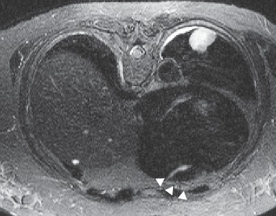 Fig. 19.79