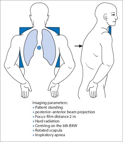 Fig. 19.23