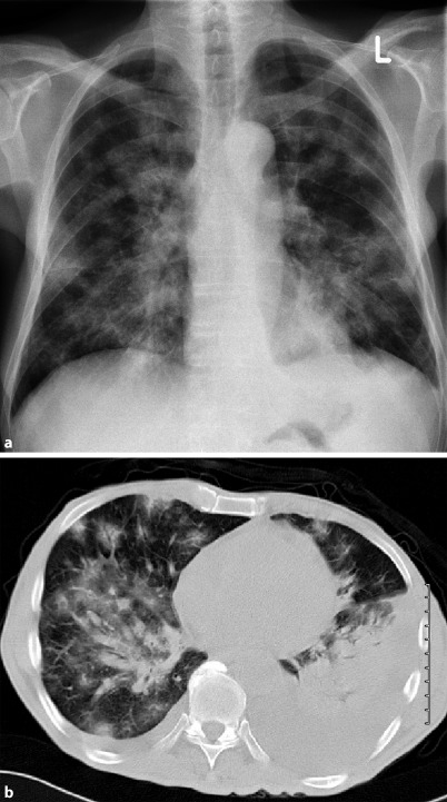 Fig. 19.93a,b