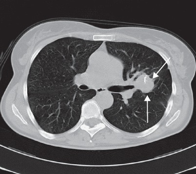 Fig. 19.89