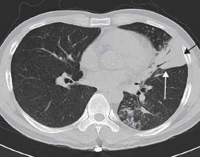 Fig. 19.56