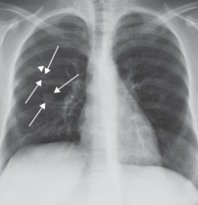 Fig. 19.60