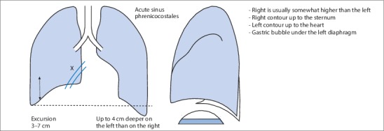 Fig. 19.14