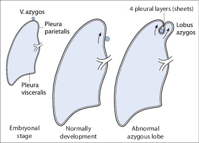Fig. 19.16