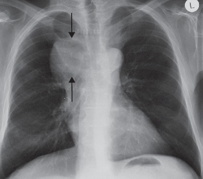 Fig. 19.9