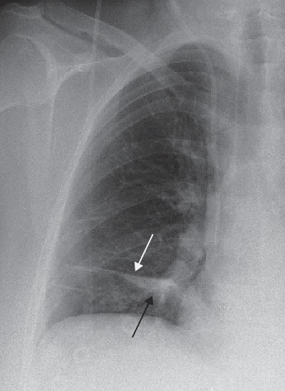 Fig. 19.37