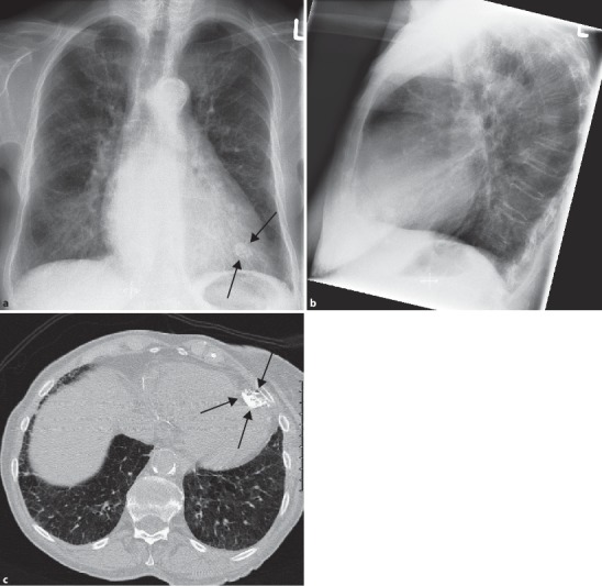 Fig. 19.119a–c