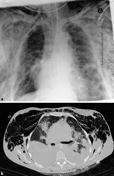 Fig. 19.118a,b