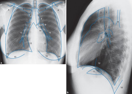 Fig. 19.1a,b