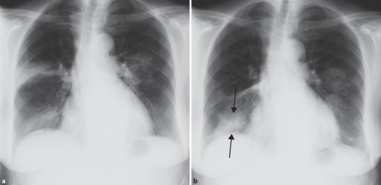 Fig. 19.49a,b