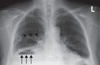 Fig. 19.25