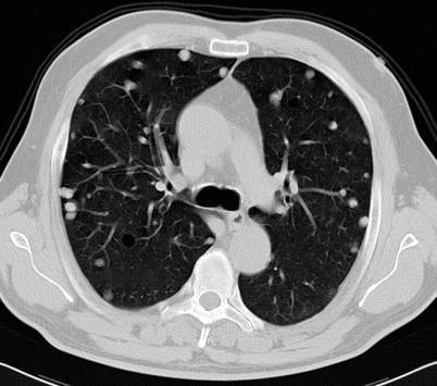Fig. 19.80