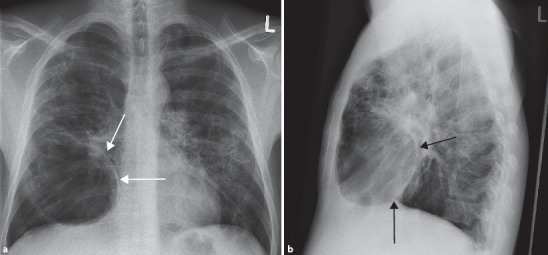 Fig. 19.34a,b