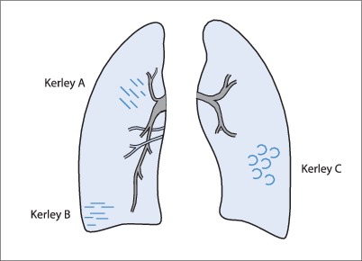 Fig. 19.95
