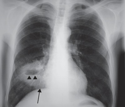 Fig. 19.47