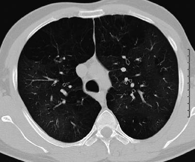 Fig. 19.33