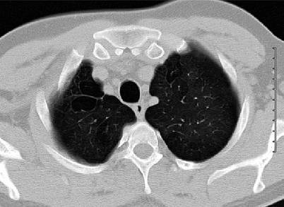 Fig. 19.32