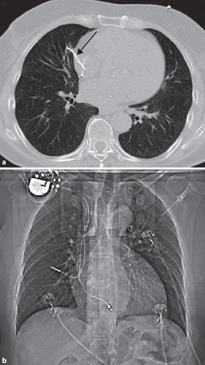 Fig. 19.100a,b