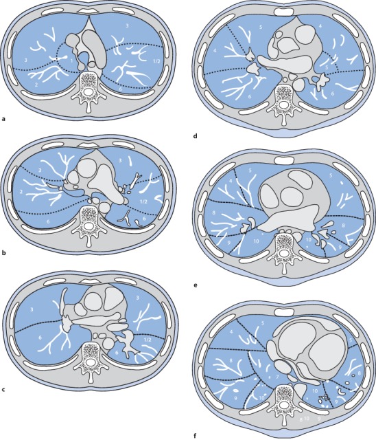 Fig. 19.4a–f