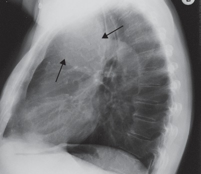 Fig. 19.10