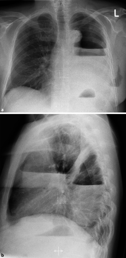 Fig. 19.102a,b