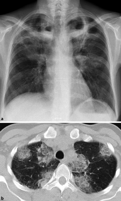 Fig. 19.53a,b